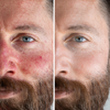LED Face Mask Red Light Therapy