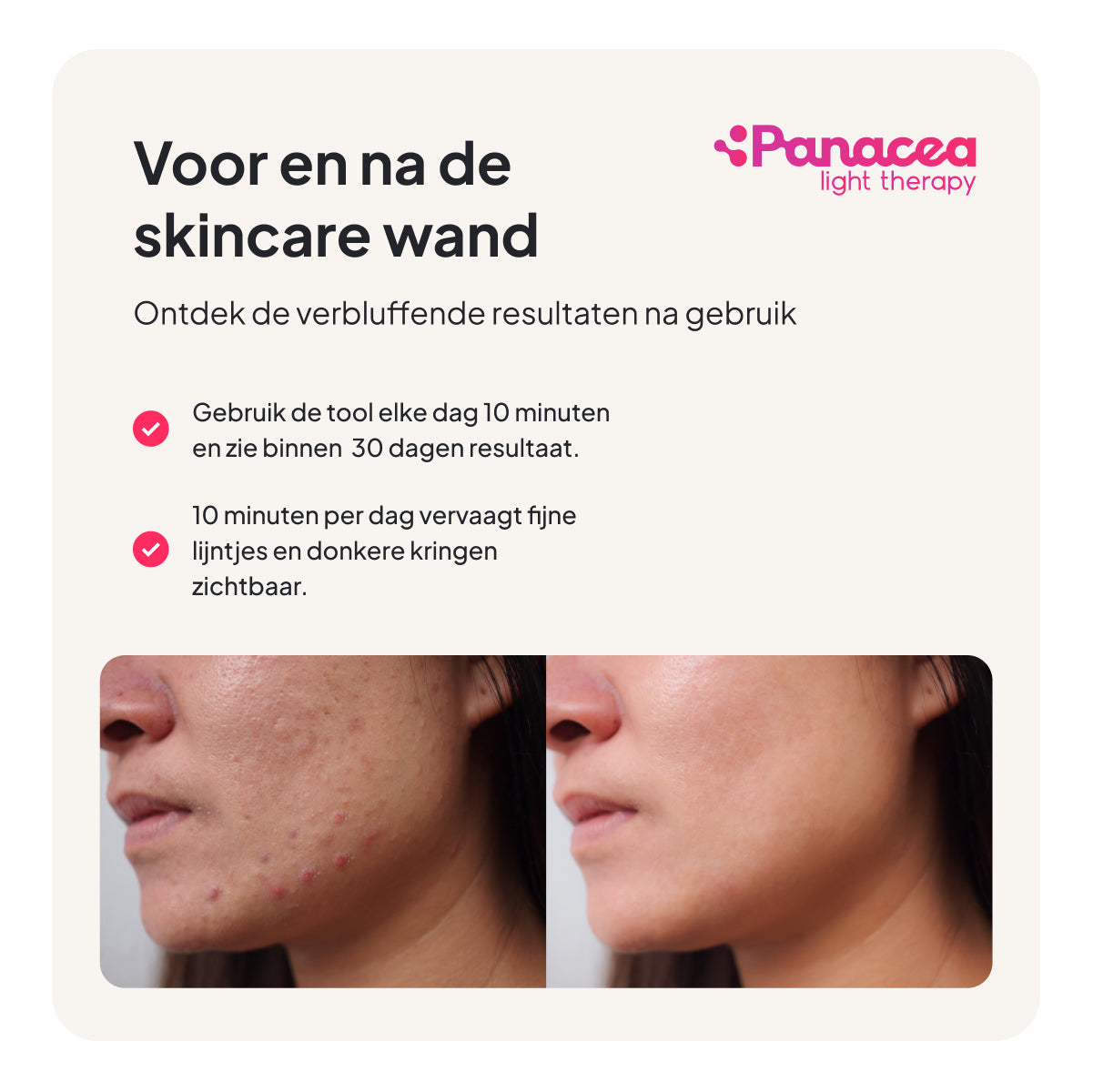 4-in-1-Hautpflege-Rotlicht-Therapiestab